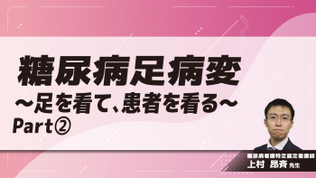 糖尿病足病変～足を看て、患者を看る～ Part②病態/要因/リスクとアセスメント