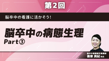 脳卒中の看護に活かそう！ 【第2回】脳卒中の病態生理 Part③脳出血/くも膜下出血(SAH)