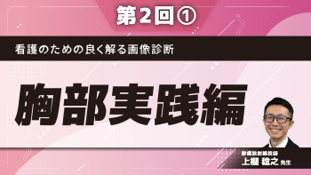 看護のための良く解る画像診断 【第2回】胸部実践編 Part①