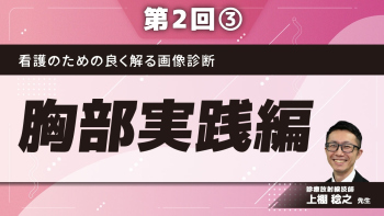 看護のための良く解る画像診断 【第2回】胸部実践編 Part③